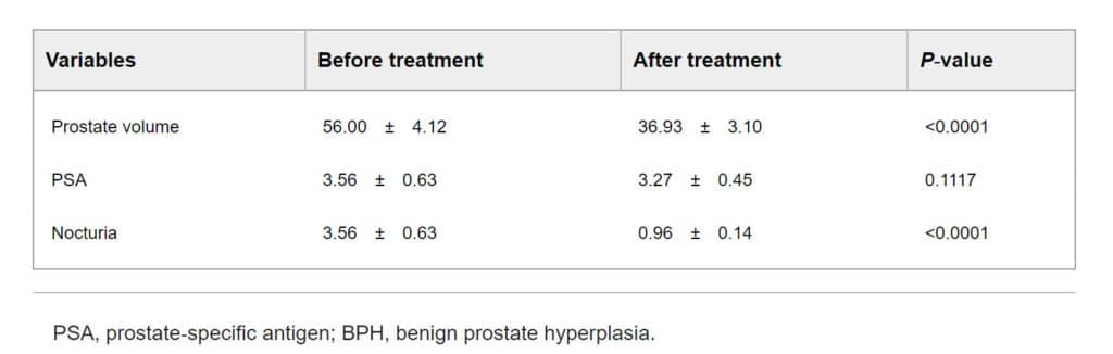 Varicocele Treatment Results