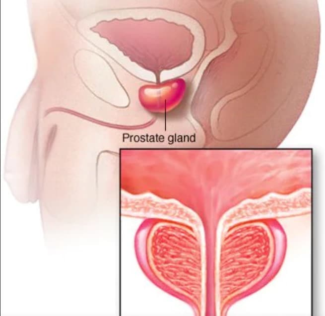 prostate gland|yourhealthyprostate.com-Your Healthy Prostate